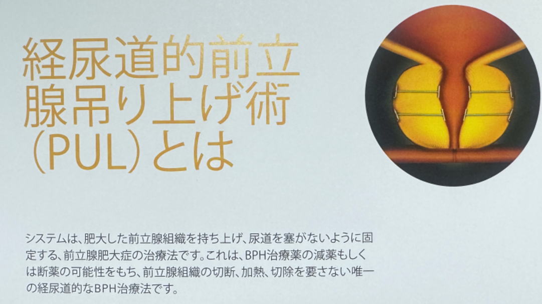 長居おき腎・泌尿器科クリニックのウロリフト解説